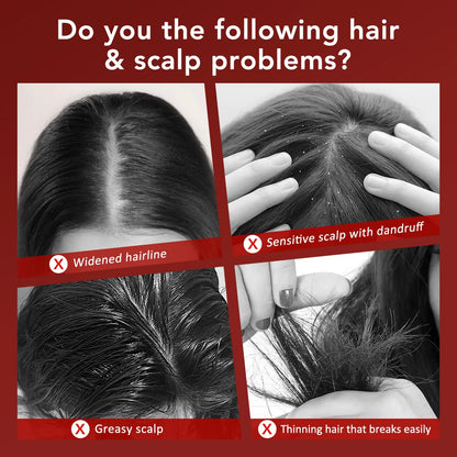 VIDA Scalp Therapy Brush™